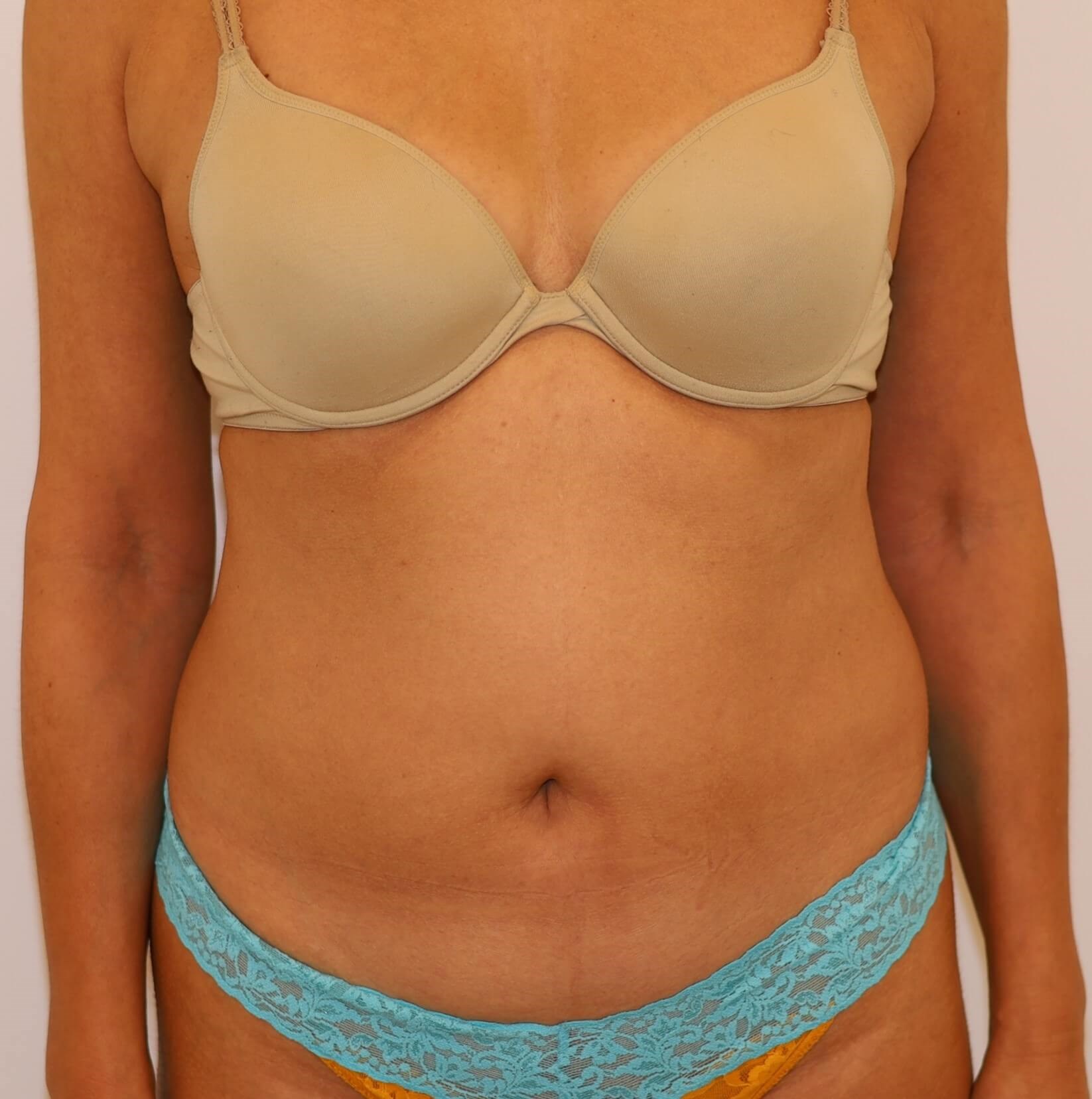 Before Image