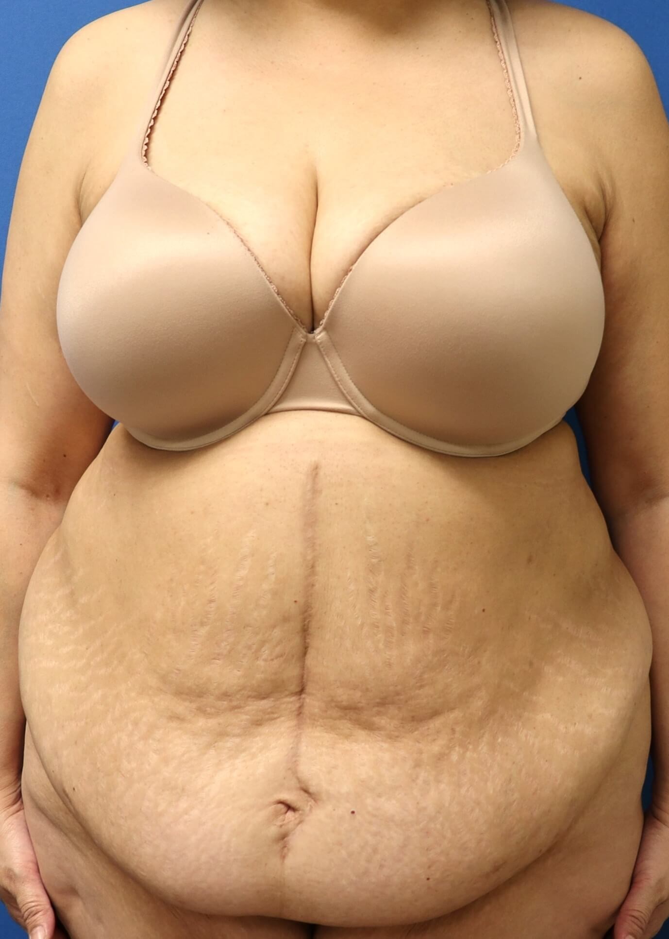 Before Image