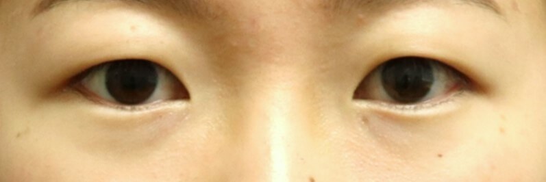 Before Image