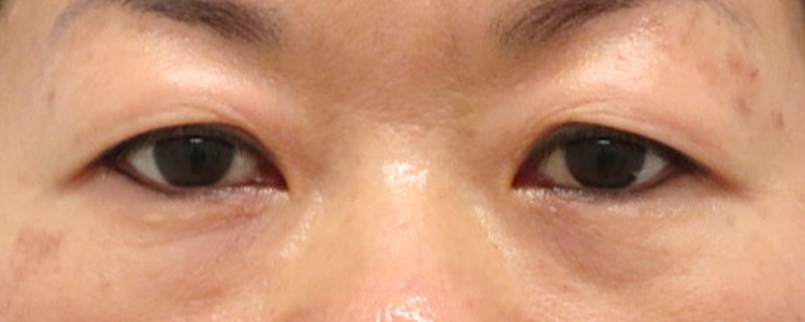 Before Image