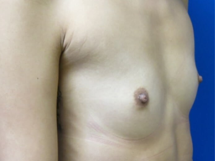 Before Image