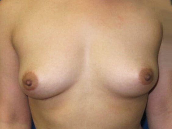Before Image