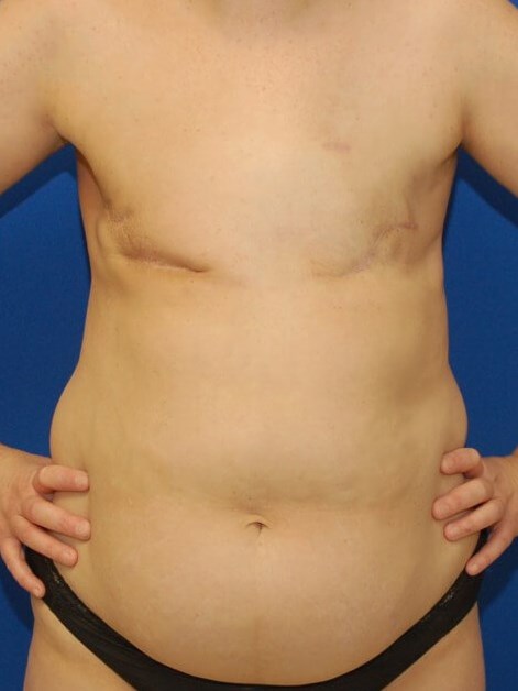 Before Image