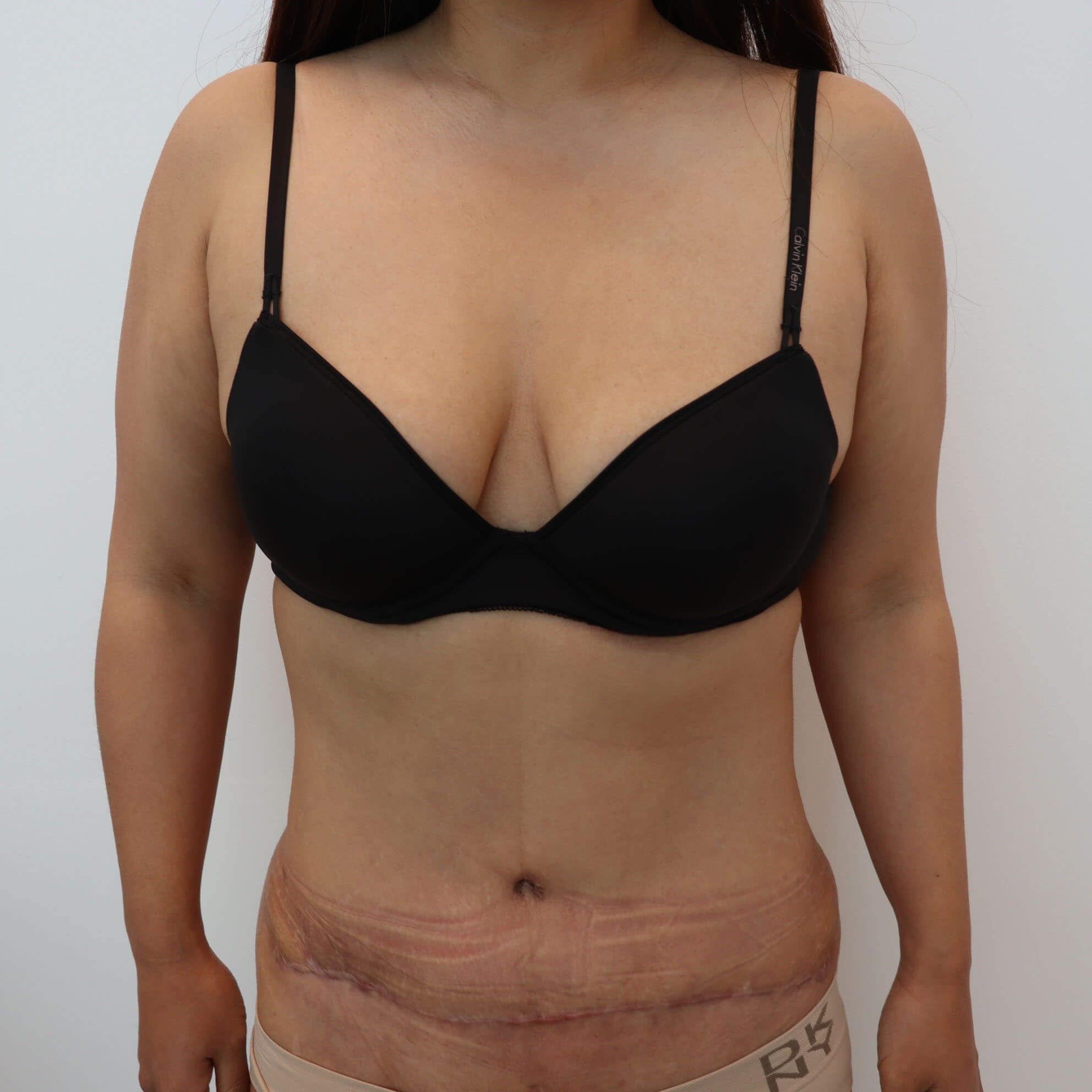After Image