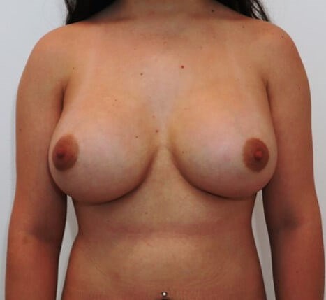 After Image