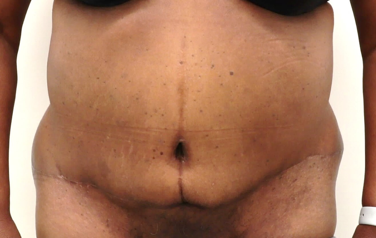 After Image