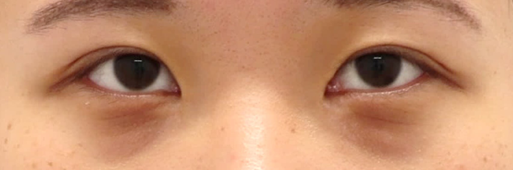 After Image