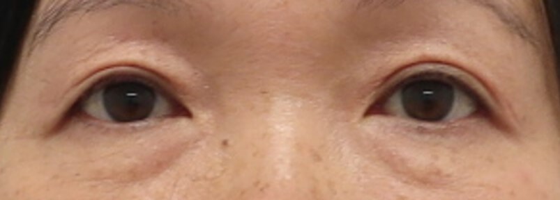 After Image