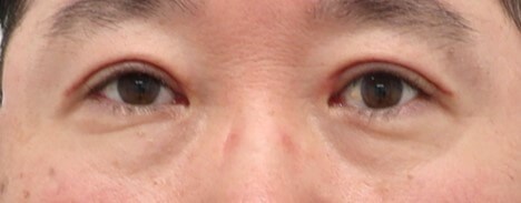 After Image