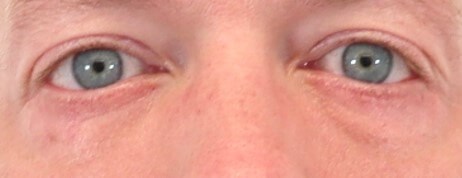After Image