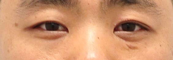 Before Image