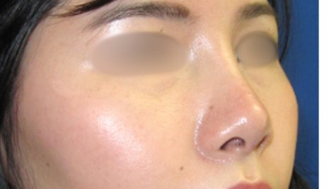 After Image