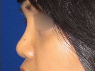 After Image