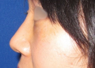 After Image