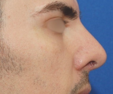 After Image