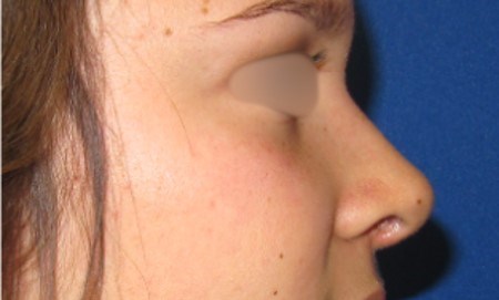 After Image
