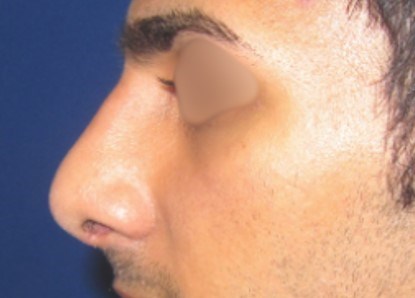 After Image