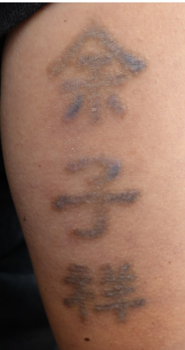 After Image