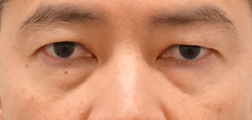 Before Image