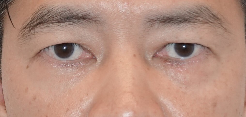 After Image