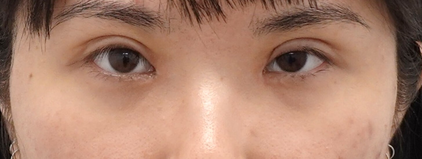 After Image