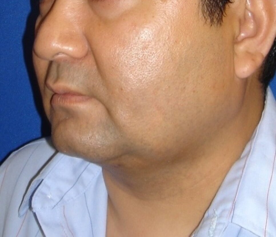 After Image