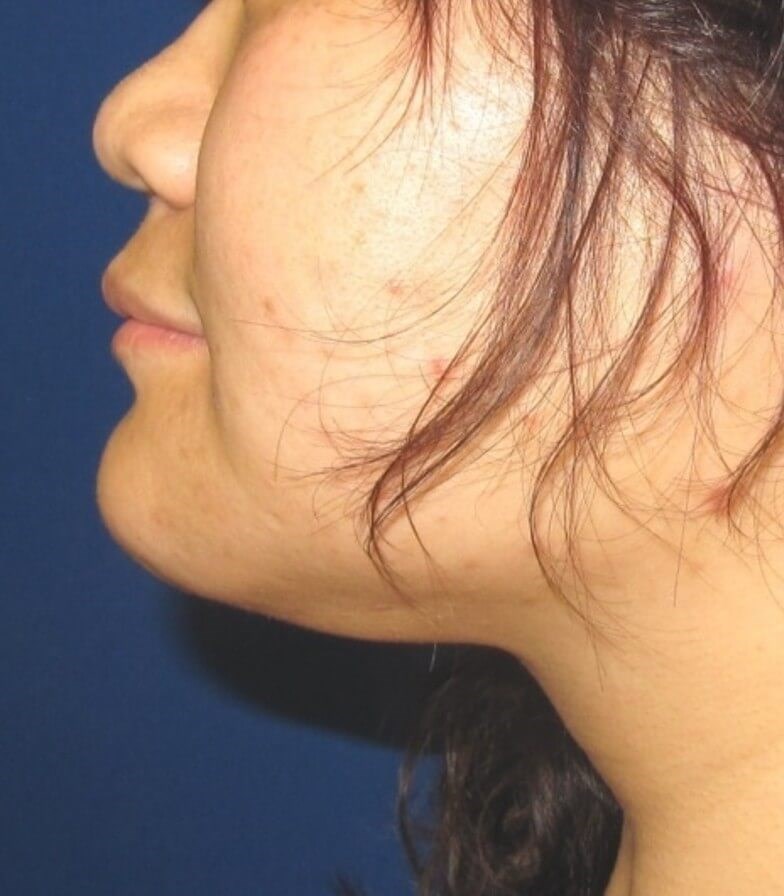 After Image