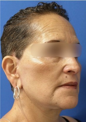 After Image