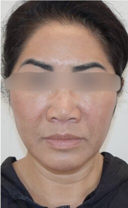 After Image
