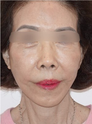 After Image