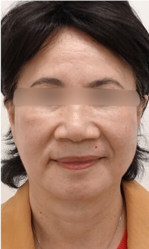 After Image