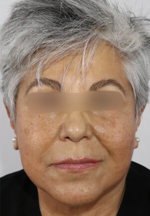 After Image