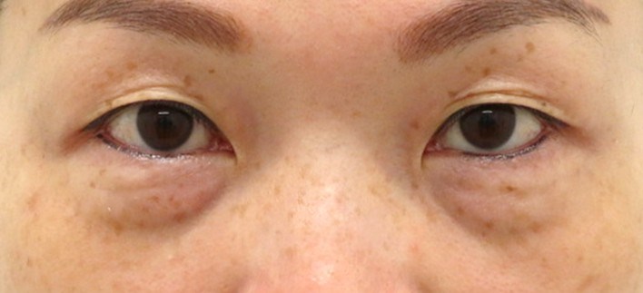 Before Image