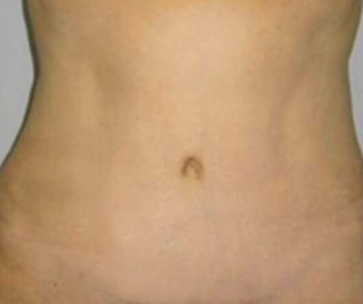 After Image