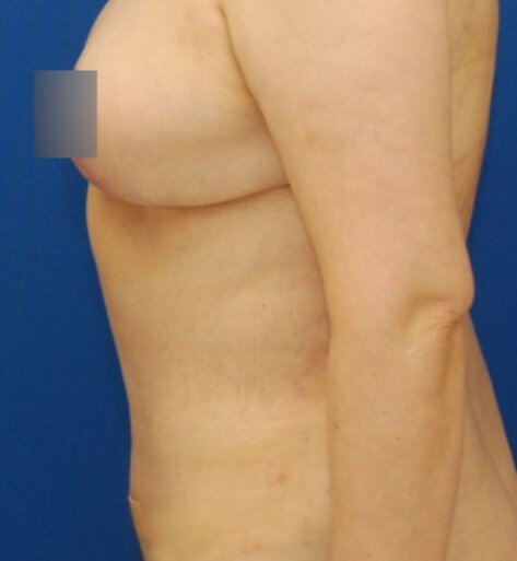 After Image