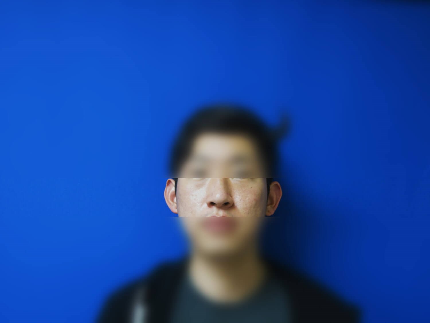Before Image