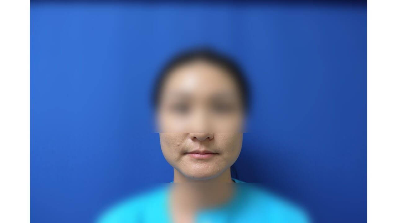Before Image