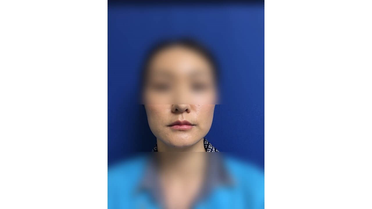 After Image