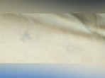 Laser Tattoo Removal After