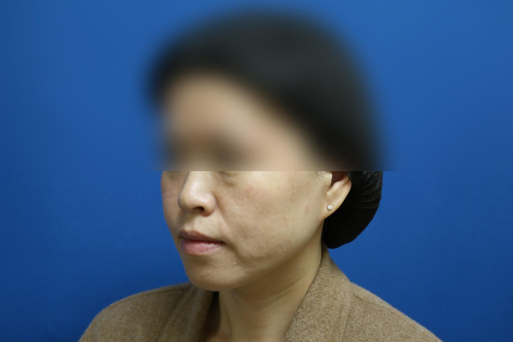 After Image