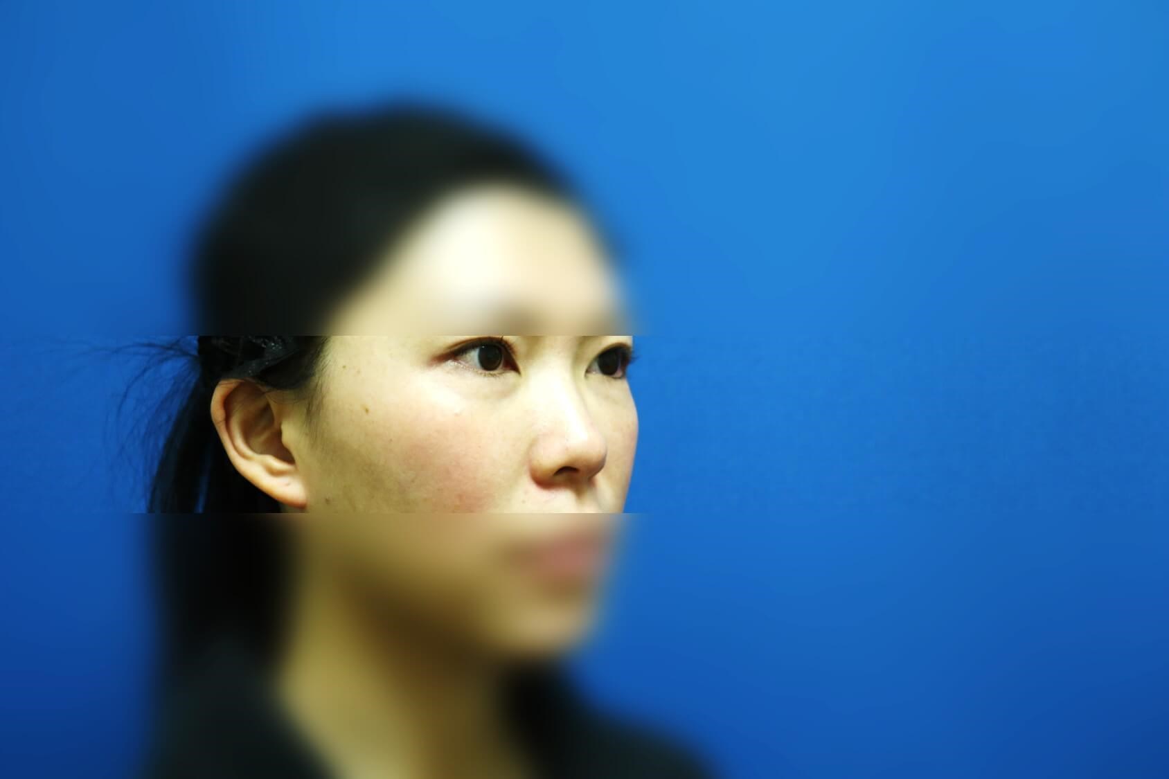 After Image