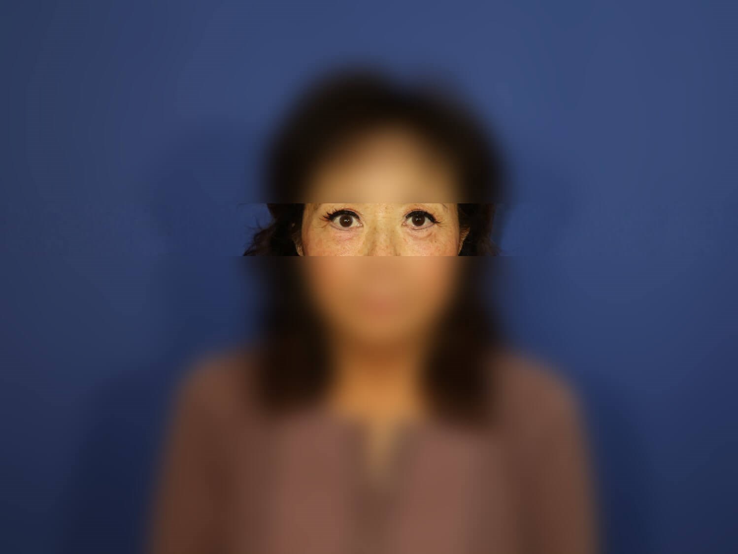 After Image
