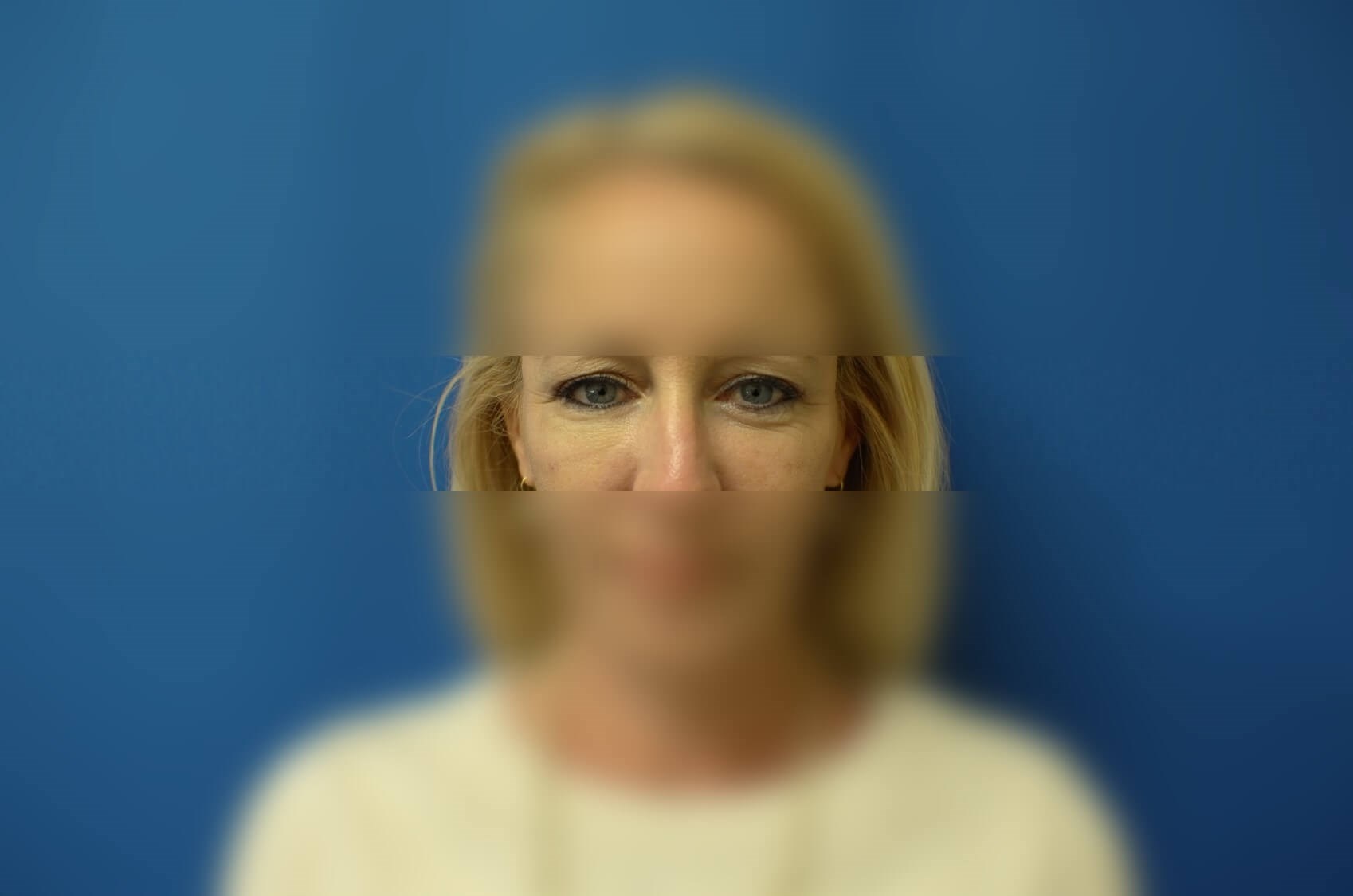 After Image
