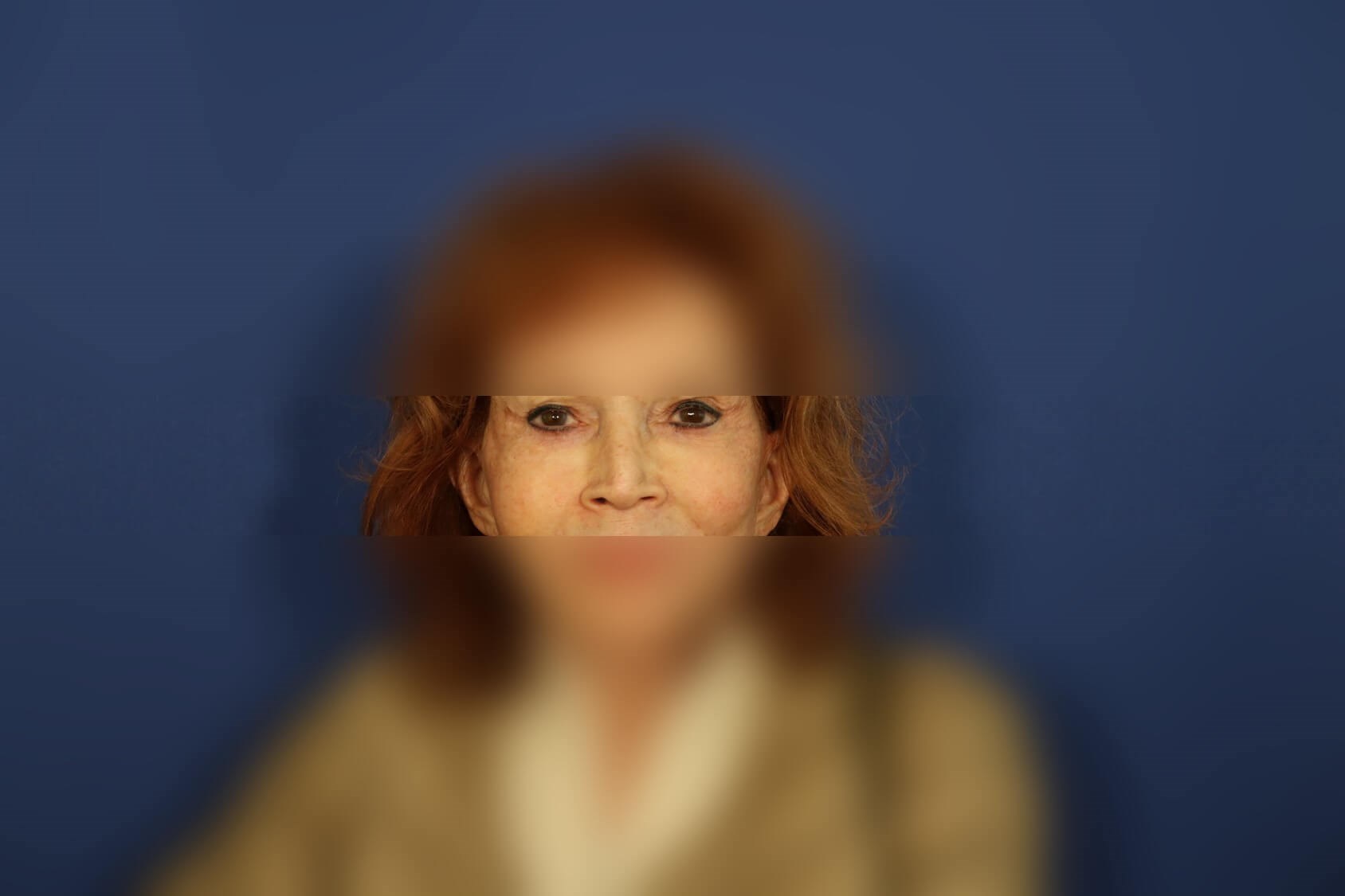 After Image