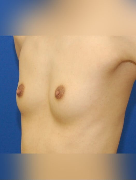 Before Image