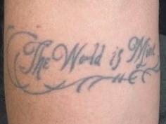 Laser Tattoo Removal Before
