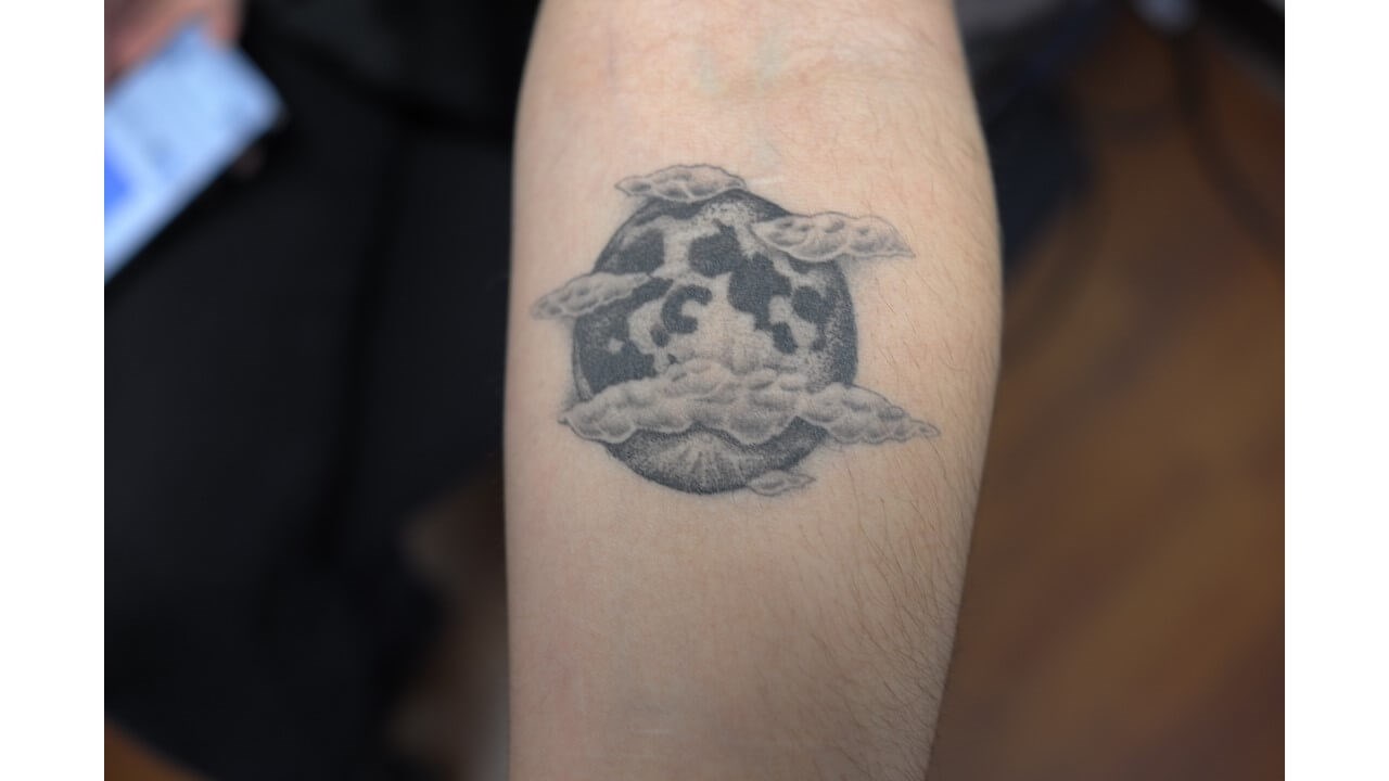 Laser Tattoo Removal Before