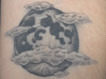 Laser Tattoo Removal Before