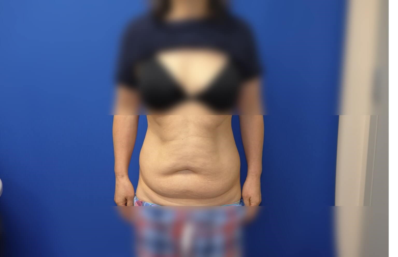 Before Image