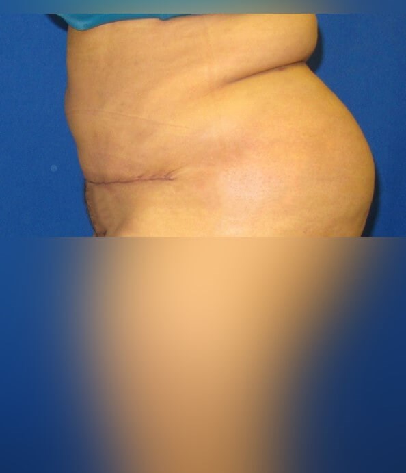 After Image